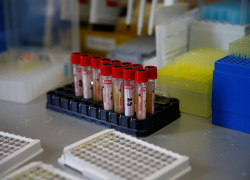 Краснодар, Горячий Ключ и Кавказский район лидируют по заболевшим коронавирусом на 4 декабря 