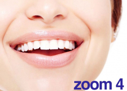 «50 оттенков белого»: В Краснодаре раскрыли секрет голливудской улыбки