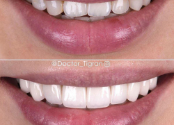 В Новый год с новой улыбкой 