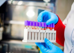 В Краснодарском крае 82 новых случая заражения коронавирусом