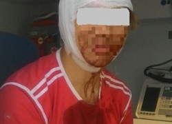 Упавший камень раскроил голову рыбаку на пляже в Геленджике