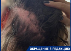 «Разбил телефон, чтобы не вызвала полицию»: сожитель подруги свирепо избил краснодарку и исчез