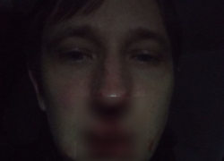 Депутата районного Совета в Ейске избили «прокурор» и «помощник судьи» за просьбу сделать музыку потише 