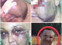 Искусал и забил до потери сознания жительницу Кубани приезжий из Питера