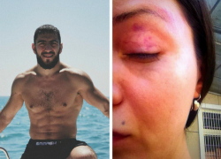 Московская модель обвинила олимпийского борца в избиении в Сочи