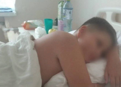 «Галлюцинации и липкий пот»: ребёнок 6 дней провел в больнице после укуса паука Чёрная Вдова в Краснодарском крае