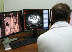 «Спасибо за подаренную мне жизнь!»: онкологи Краснодарского края провели уникальнейшую операцию