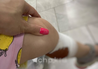 Стая бродячих собак напала на двухлетнюю девочку в Краснодаре