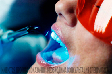 Отбеливание зубов в клинике  Доктора Шумаева.