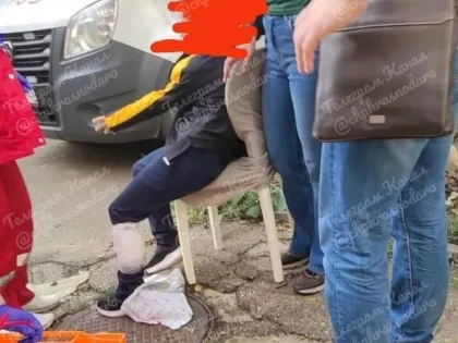 СК возбудил дело после нападения своры собак на школьника в Краснодаре 