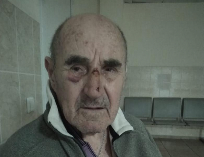 Перелом носа и предплечья: девочка на электросамокате сбила пенсионера в Краснодаре и скрылась 