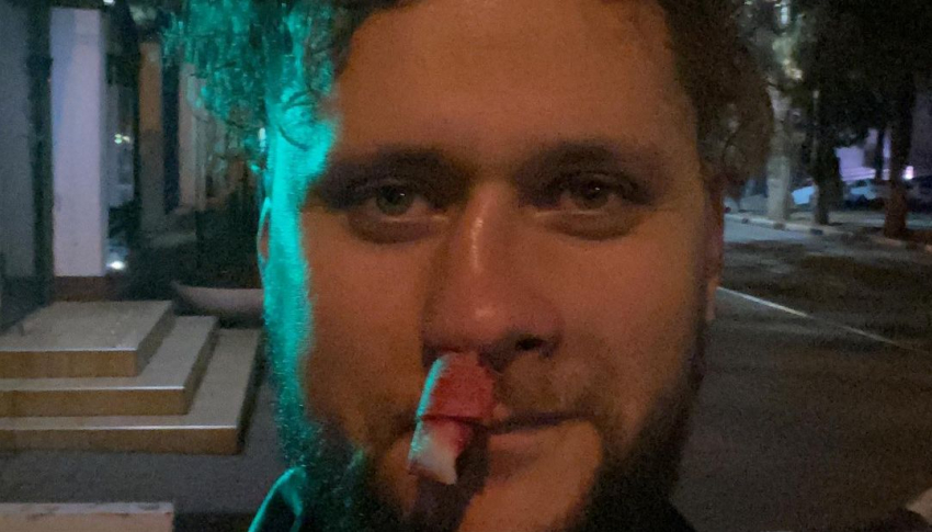 Вокалисту группы «Бакс Бани» во время выступления в Геленджике слушатель сломал нос