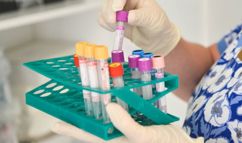 Лаборатория для исследования анализов на коронавирус открылась в Сочи
