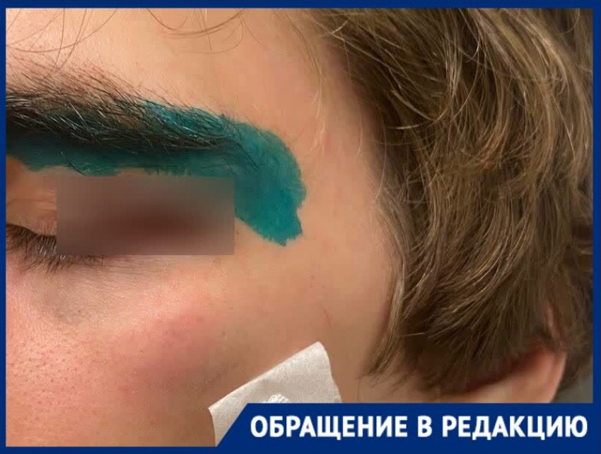 «Ударил подростка в глаз и пробил веко»: потасовка в Краснодаре закончилась больничным и уголовным делом
