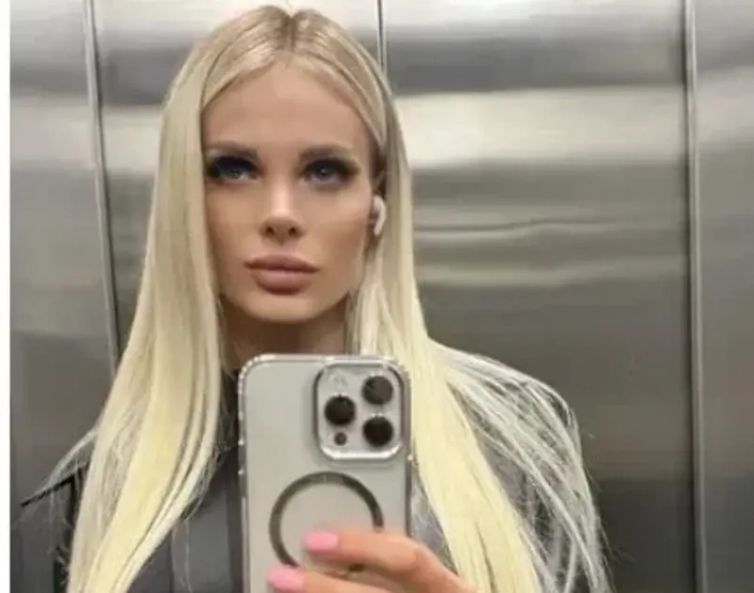 Перенесла трепанацию черепа: пропавшую модель из Краснодара нашли в больнице и возбудили уголовное дело  