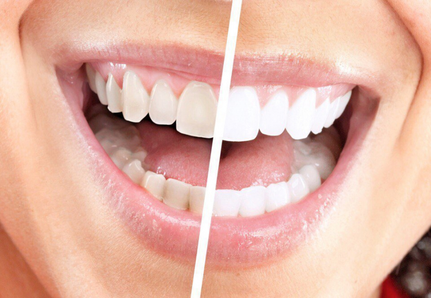  Как часто нужно посещать стоматолога краснодарцам? 