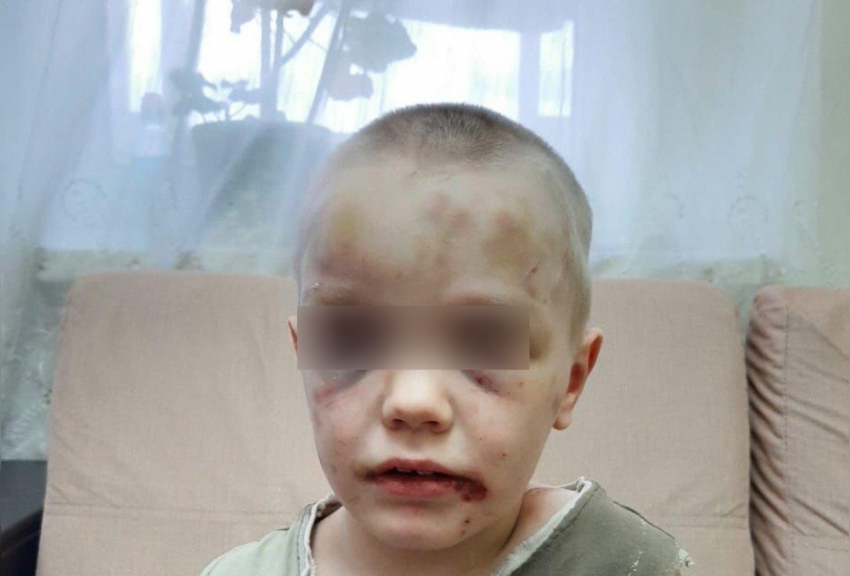 Жительницу Кубани, избивавшую 6-летнего сына, просят лишить родительских прав