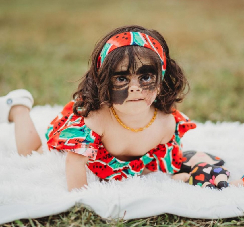 Девочка с «маской Бэтмена» возвращается в Краснодар