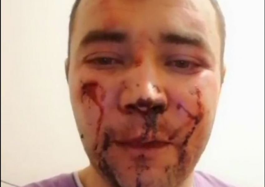 Председатель совета дома ЖК «Видный» в Краснодаре был избит двумя неизвестными 