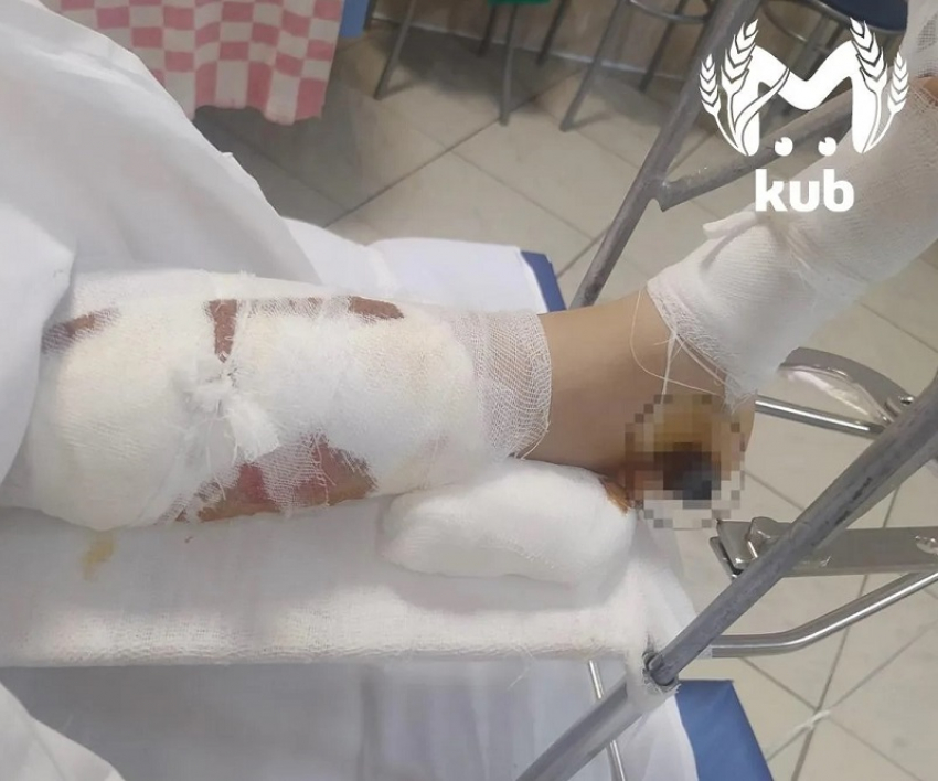 ДТП с пострадавшей школьницей в Краснодаре привлекло внимание омбудсмена России 