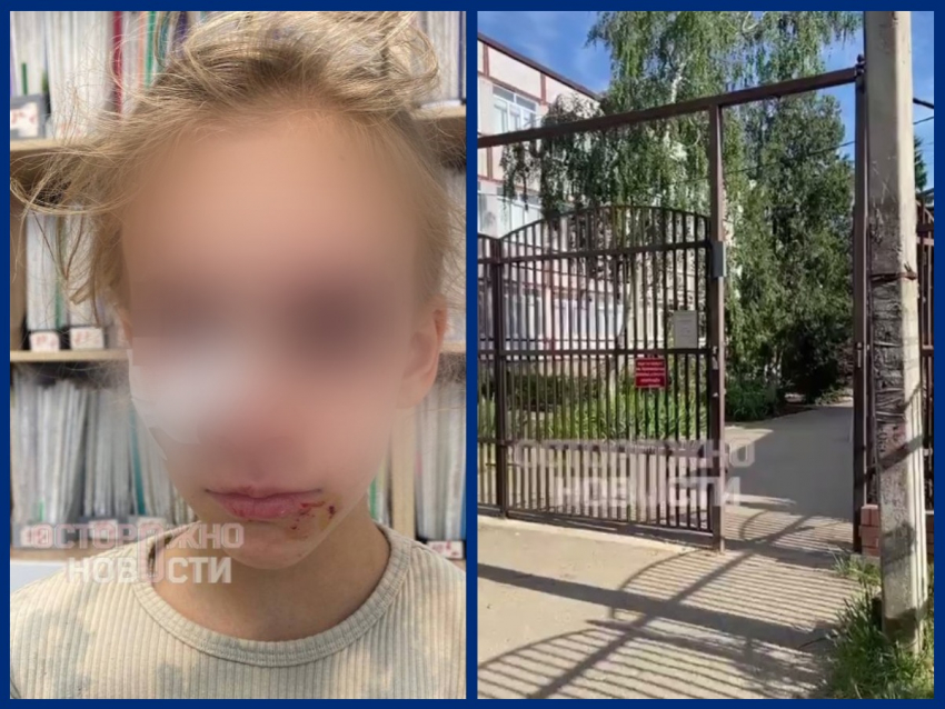 Во дворе школы в Краснодаре бездомная собака разорвала лицо 8-летней девочке 