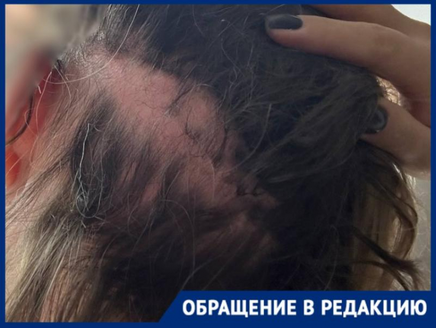 «Разбил телефон, чтобы не вызвала полицию»: сожитель подруги свирепо избил краснодарку и исчез