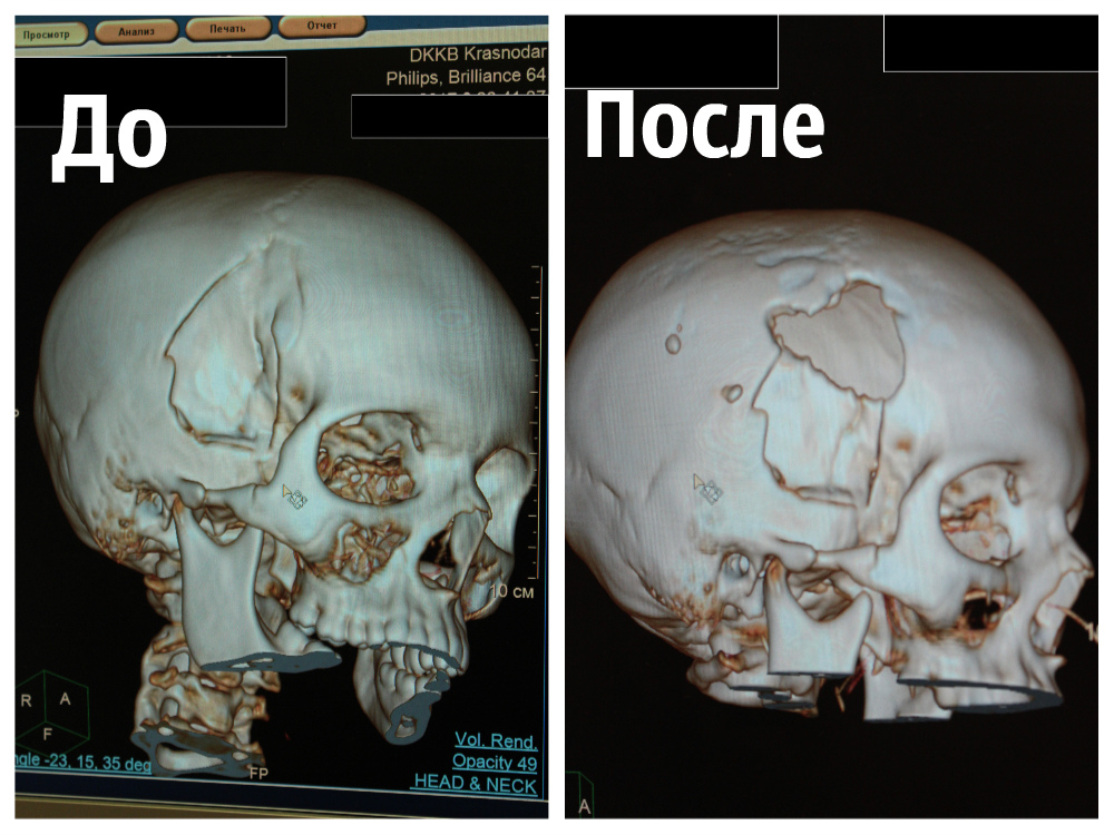 операция девочке.jpg